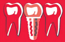 BULDENTAL, salon dentaire